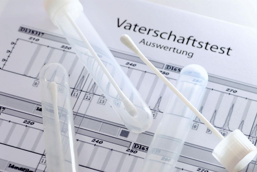 產(chǎn)前親子鑒定方法有哪些